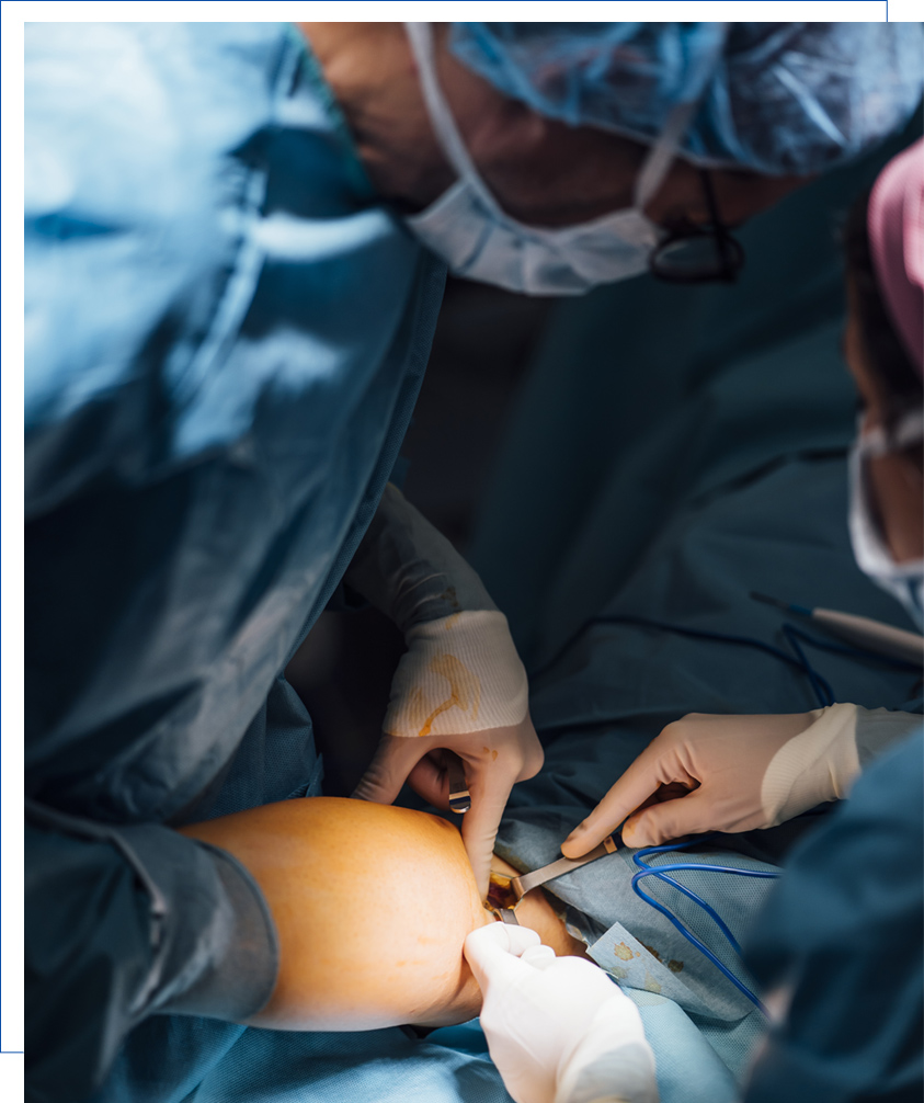 Budget knee replacement in Kolkata Budget knee replacement in Kolkata