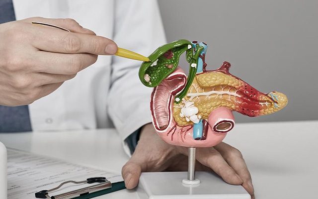 Medical model showing gallbladder anatomy and gallstones with doctor explaining gallbladder disease and treatment options
